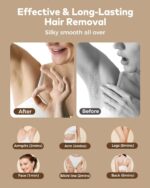 Hair Removal Device - Image 7